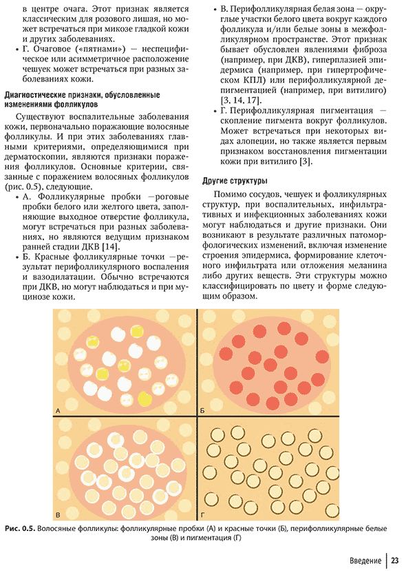 Волосяные фолликулы: фолликулярные пробки