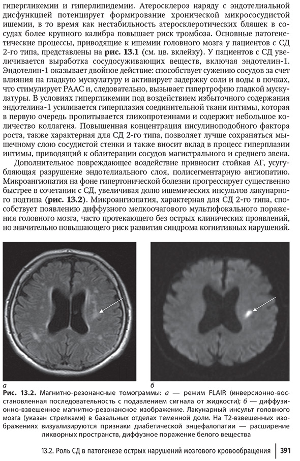 Магнитно-резонансные томограммы