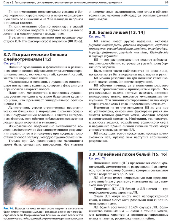 Рис. 70. Волосы на коже головы этого пациента изначально были пигментированными, но 1 год назад Рис. 70. Волосы на коже головы этого пациента изначально были пигментированными, но 1 год назад