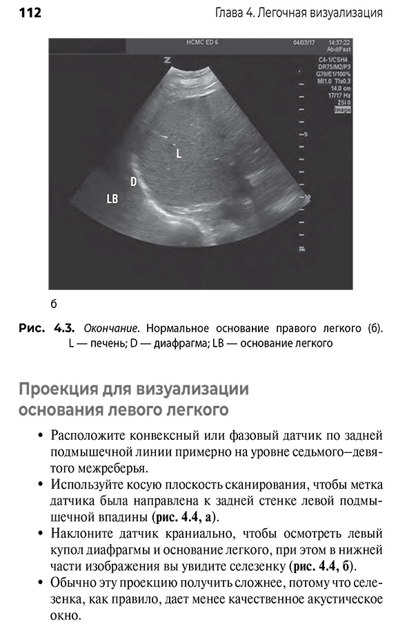Легочная визуализация