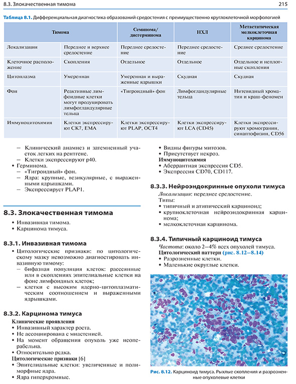 Злокачественная тимома Злокачественная тимома