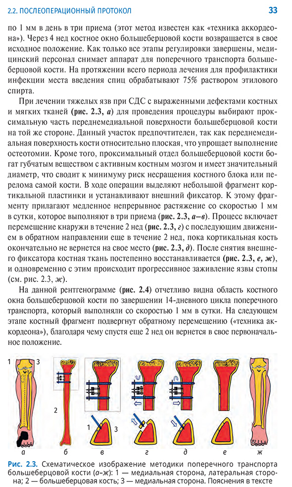 Схематическое изображение методики поперечного транспорта