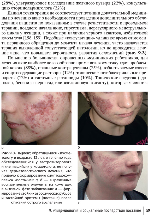 Пациент, обратившийся к косметологу в возрасте 12 лет, в течение года обследовавшийся у гастроэнтеролога и «лечившийся» у косметолога Пациент, обратившийся к косметологу в возрасте 12 лет, в течение года обследовавшийся у гастроэнтеролога и «лечившийся» у косметолога