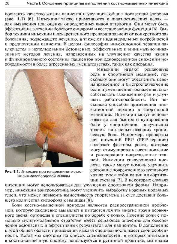 Рис. 1.1. Инъекция при тендовагините сухожилия малоберцовой мышцы Рис. 1.1. Инъекция при тендовагините сухожилия малоберцовой мышцы