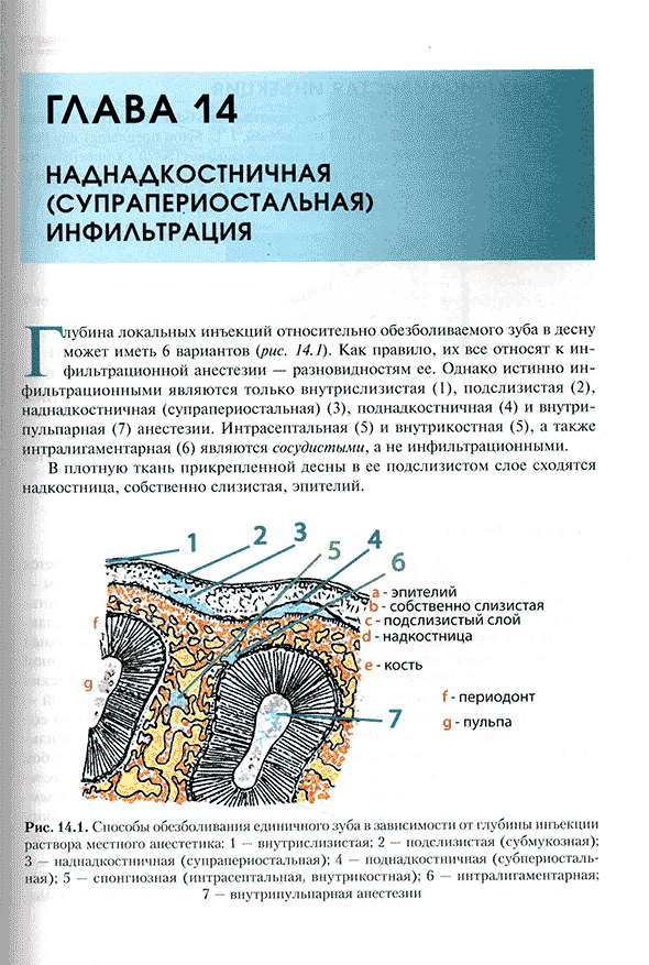 Способы обезболивания единичного зуба в зависимости от глубины инъекции Способы обезболивания единичного зуба в зависимости от глубины инъекции