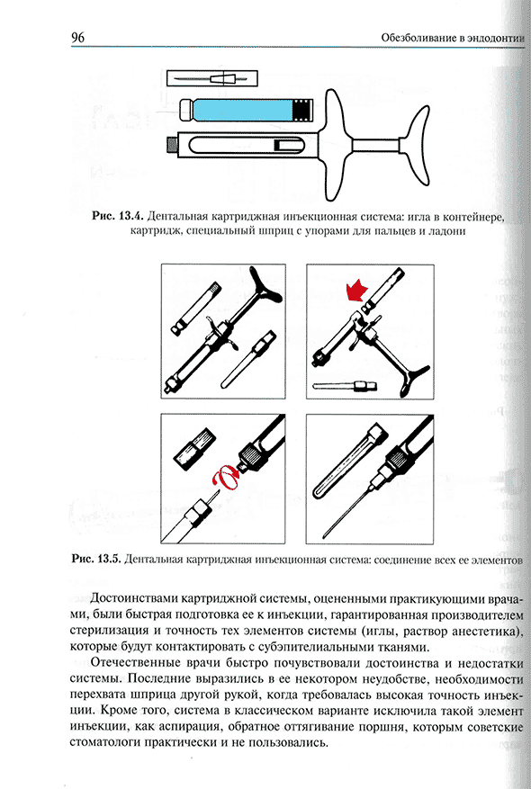 Дентальная картриджная инъекционная система: соединение всех ее элементов Дентальная картриджная инъекционная система: соединение всех ее элементов