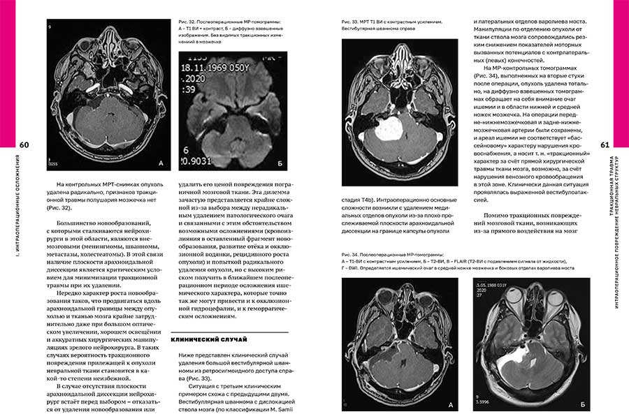 Пример страницы из книги "Осложнения операций на головном мозге" - П. Г. Шнякин
