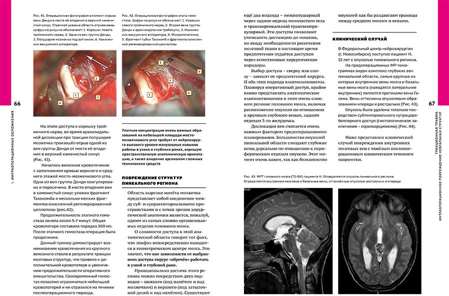 Пример страницы из книги "Осложнения операций на головном мозге" - П. Г. Шнякин