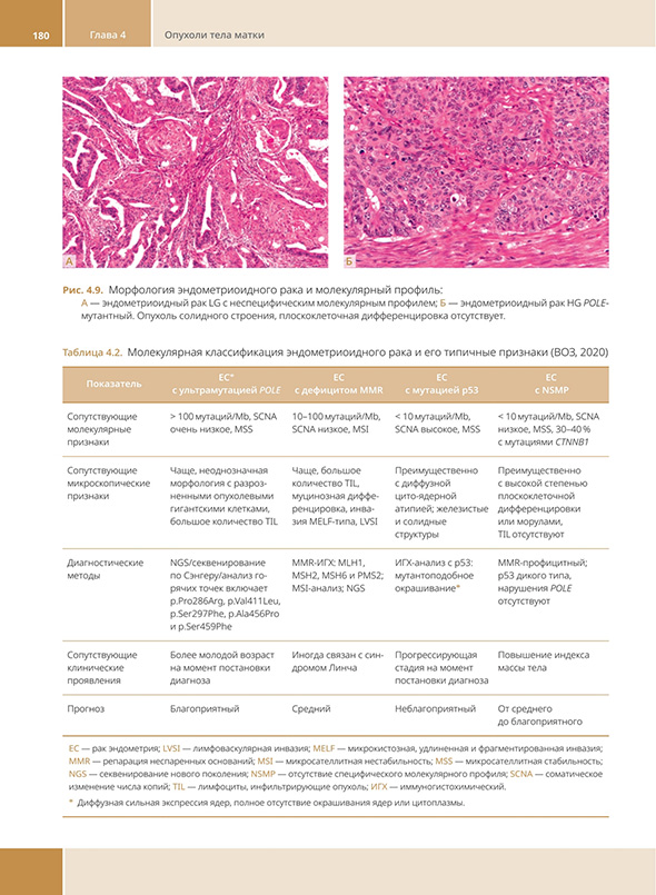 Морфология эндометриоидного рака 