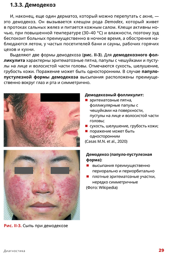 Сыпь при демодекозе