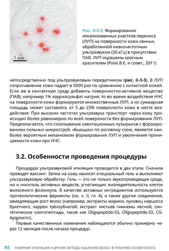 Рис. 11-3-3 Формирование локализованных участков переноса (ЛУП) на поверхности кожи свиньи Рис. 11-3-3 Формирование локализованных участков переноса (ЛУП) на поверхности кожи свиньи