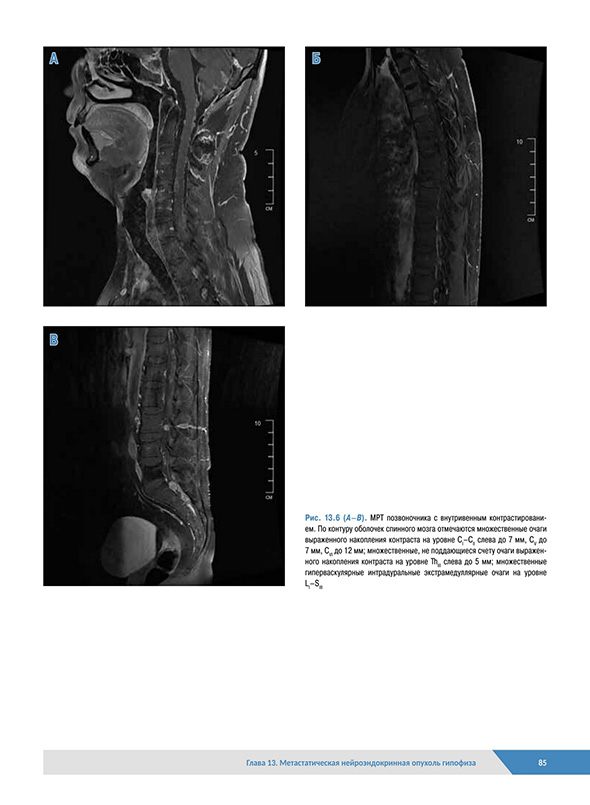 Патологическая анатомия органов эндокринной системы Патологическая анатомия органов эндокринной системы