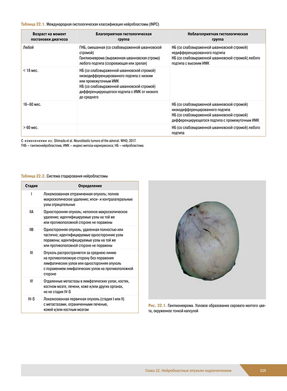 Международная гистологическая классификация нейробластомы (INPC) Международная гистологическая классификация нейробластомы (INPC)