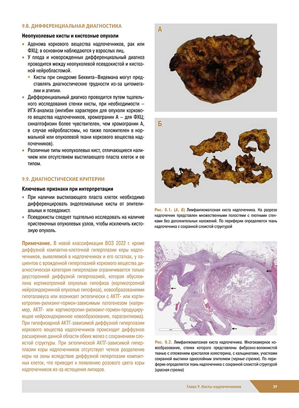 Неопухолевые кисты и кистозные опухоли Неопухолевые кисты и кистозные опухоли