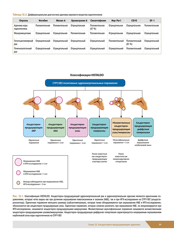 Классификация HISTALDO Классификация HISTALDO