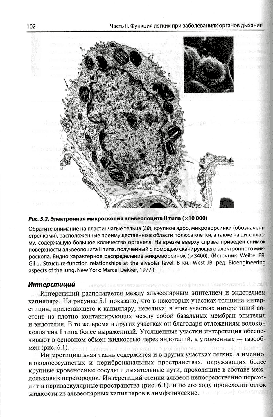 Рис. 5.2. Электронная микроскопия альвеолоцита II типа