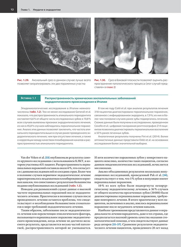 Распространенность хронических воспалительных заболеваний эндодонтического происхождения в Италии