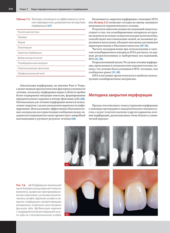 Методика закрытия перфорации