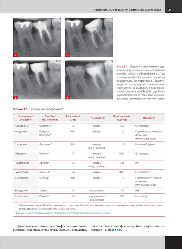 Периапикальные поражения и системные заболевания 