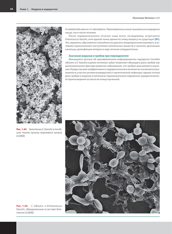 Значение вирусов и грибов при периодонтите