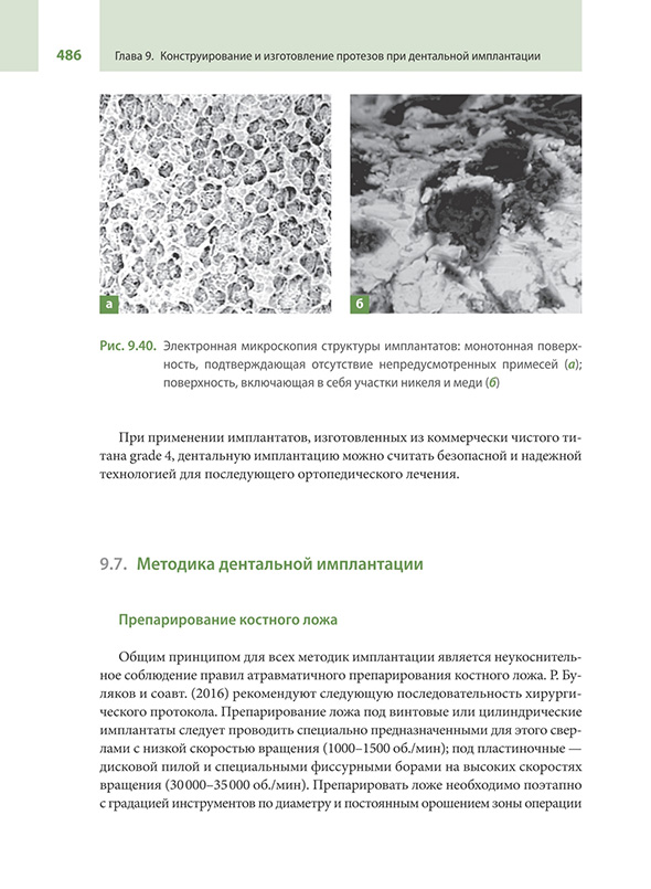 Электронная микроскопия структуры имплантатов Электронная микроскопия структуры имплантатов