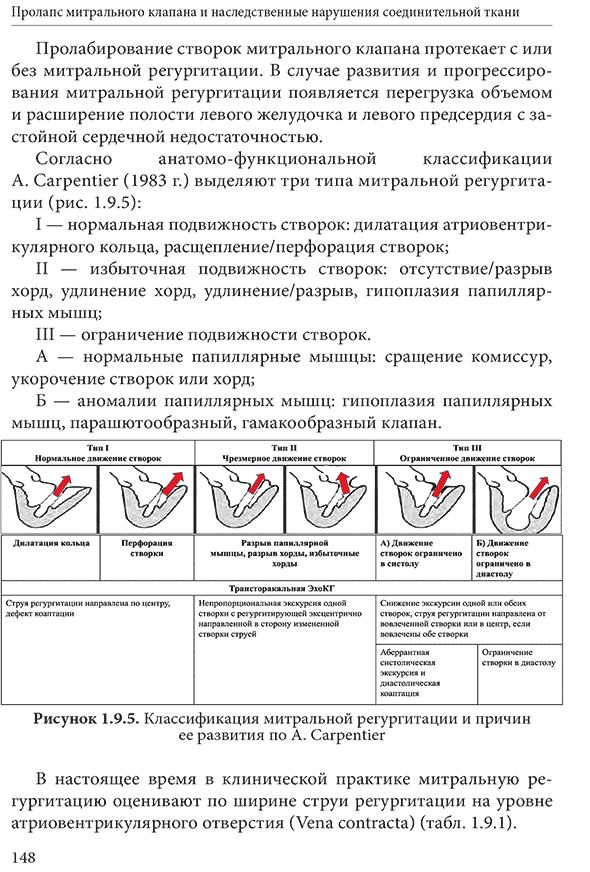 Рисунок 1.9.5. Классификация митральной регургитации и причин ее развития по A. Carpentier