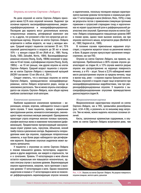 Опухоль из клеток Сертоли–Лейдига