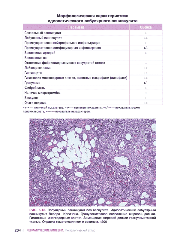 Морфологическая характеристика идиопатического лобулярного панникулита