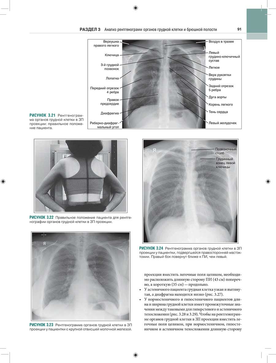 Рисунок 3.22 Правильное положение пациента для рентгенографии органов грудной клетки в ЗП проекции.