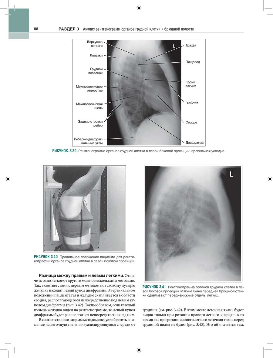 Рисунок 3.40 Правильное положение пациента для рентгенографии органов грудной клетки в левой боковой проекции.