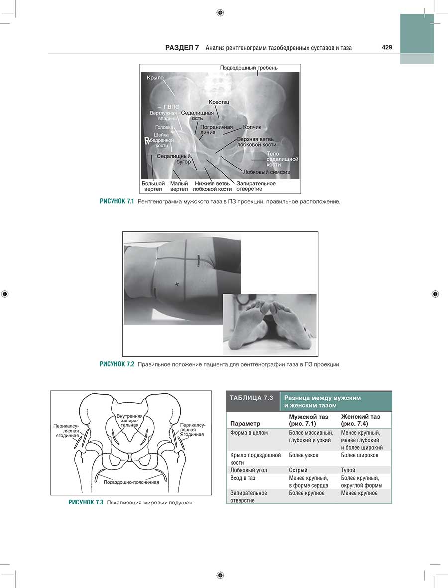 Рисунок 7.2 Правильное положение пациента для рентгенографии таза в ПЗ проекции