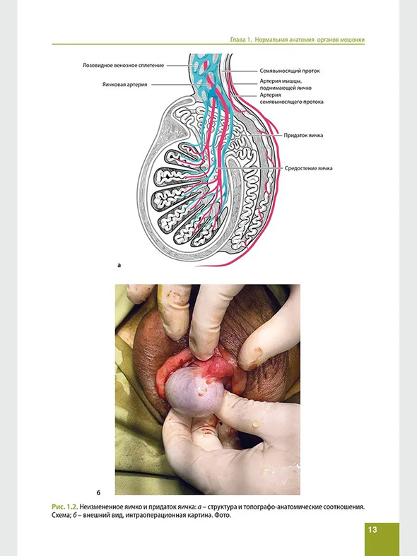 Неизмененное яичко и придаток яичка: о - структура и топографо-анатомические соотношения.