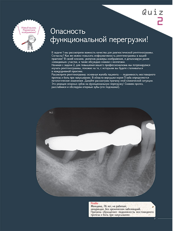 В задаче 1 мы рассмотрели важность качества для диагностической рентгенограммы. 