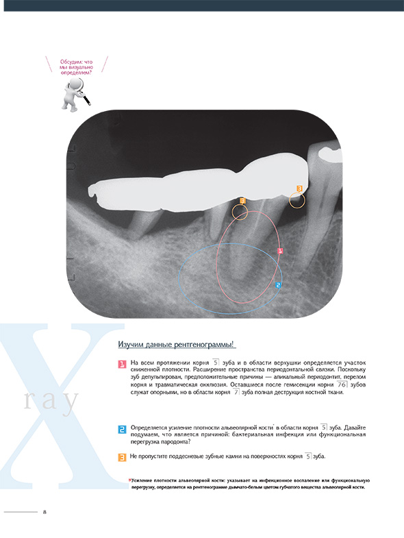 Изучим данные рентгенограммы!
