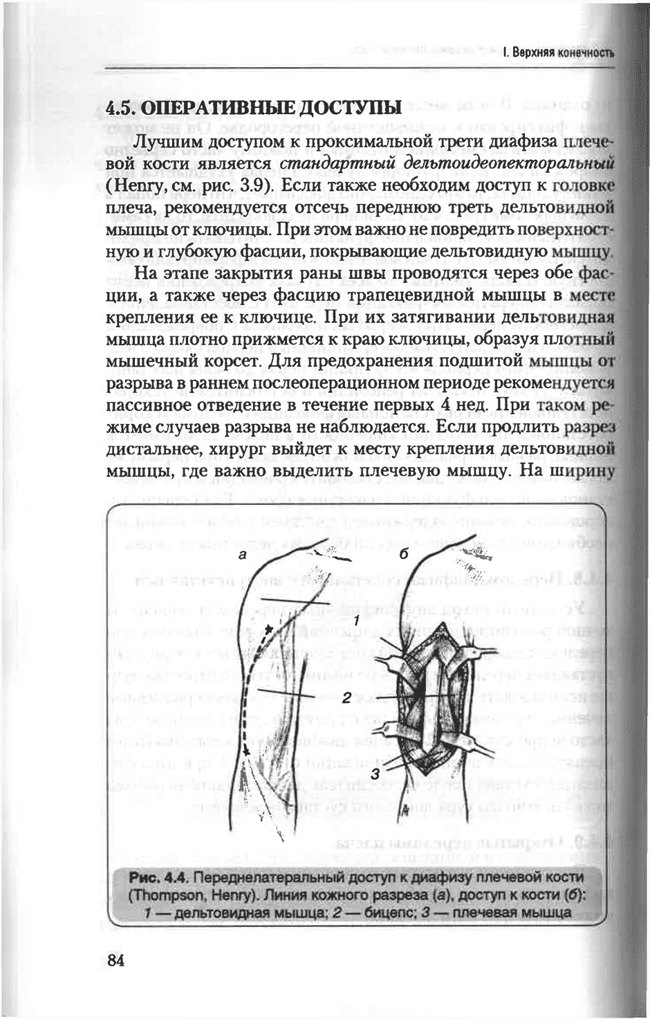 Рис. 4.4. Переднелатеральный доступ к диафизу плечевой кости