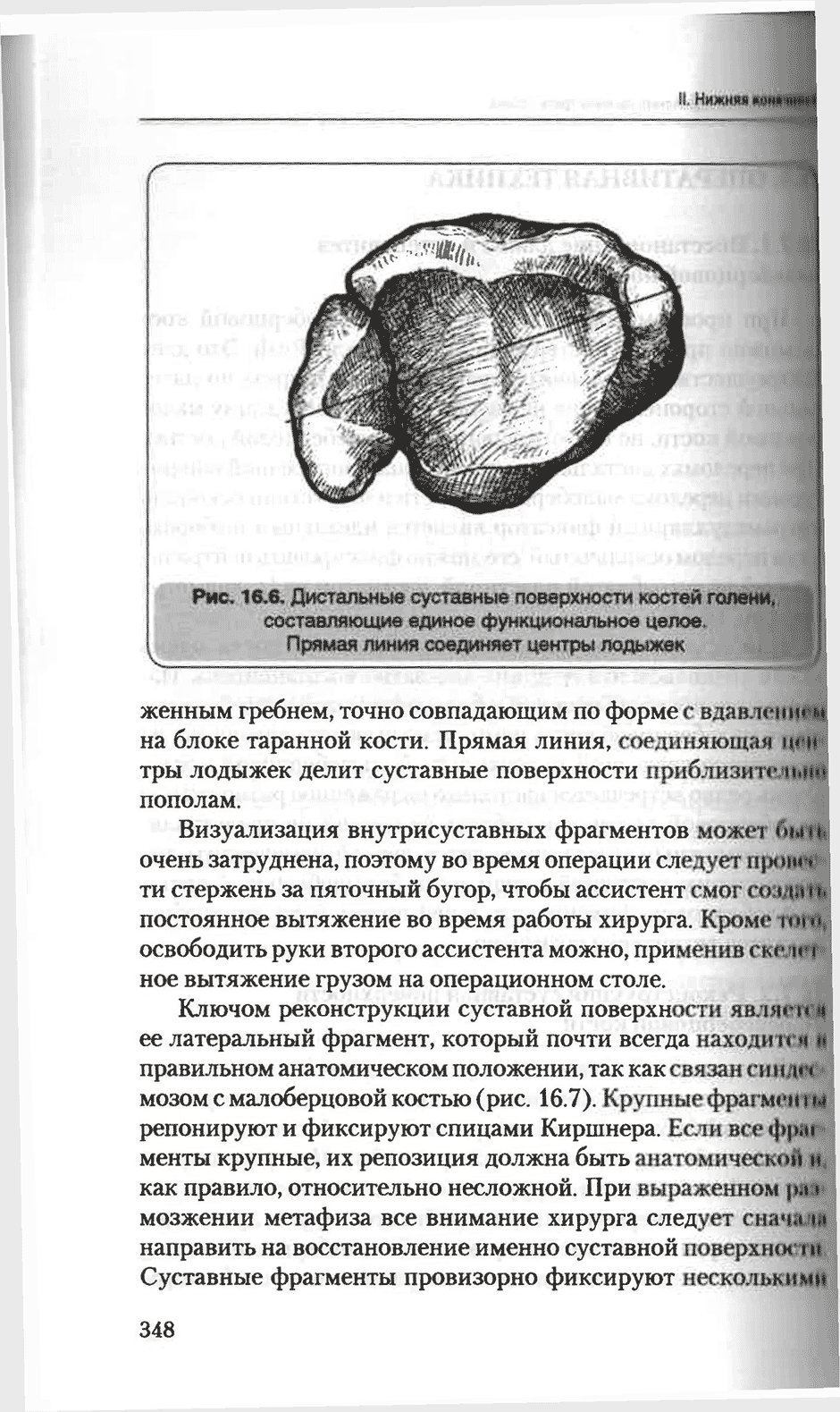 Рис. 16.6. Дистальные суставные поверхности костей голени.