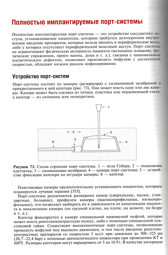 Схема строения порт-системы.