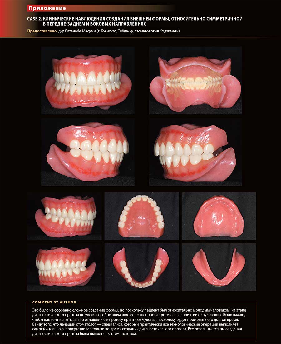 Примеры страниц из книги "Практическое пособие. Стандарт полного съемного зубного протеза. Лечит стоматолог, создает зубной техник"