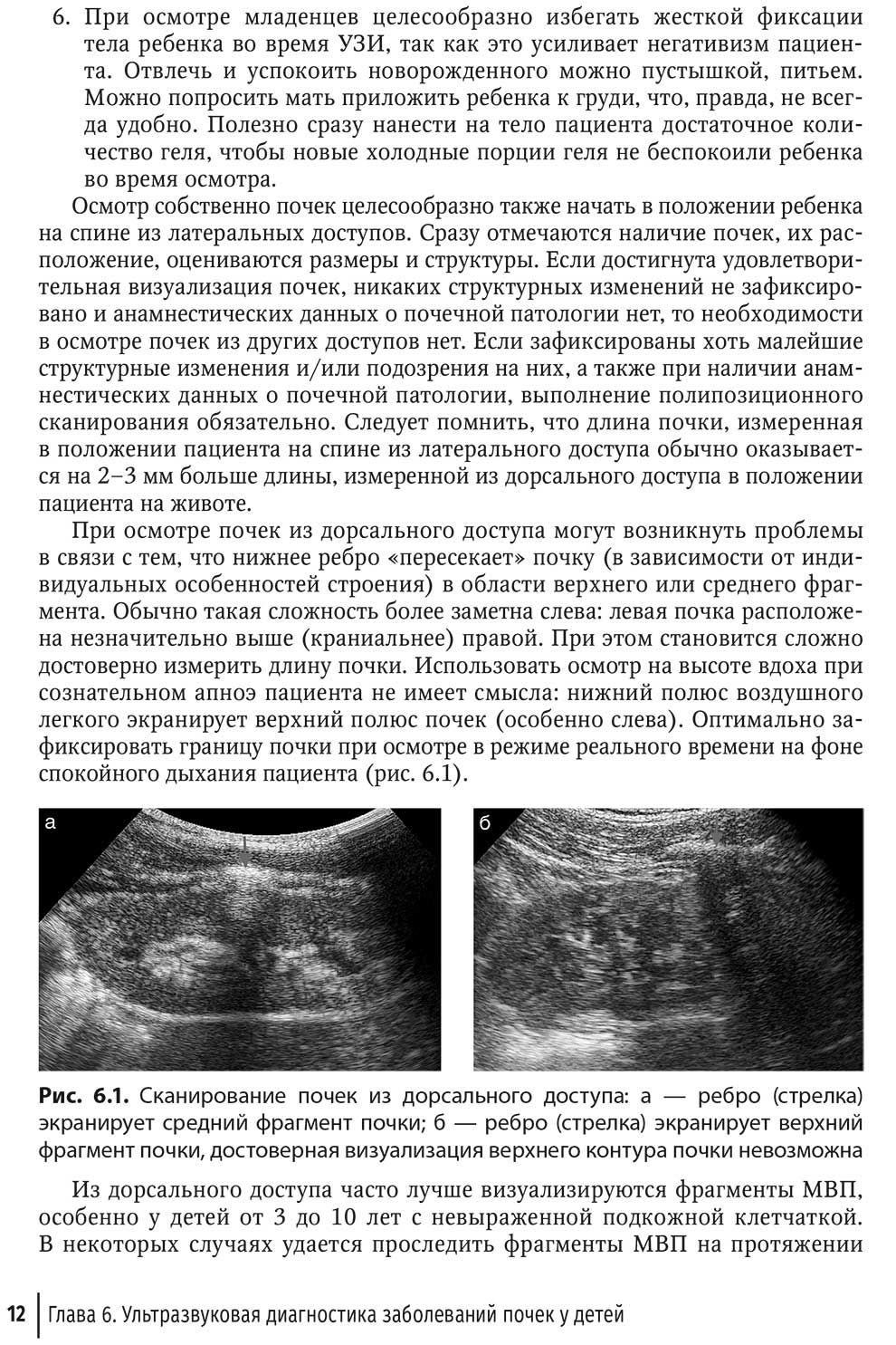 Сканирование почек из дорсального доступа