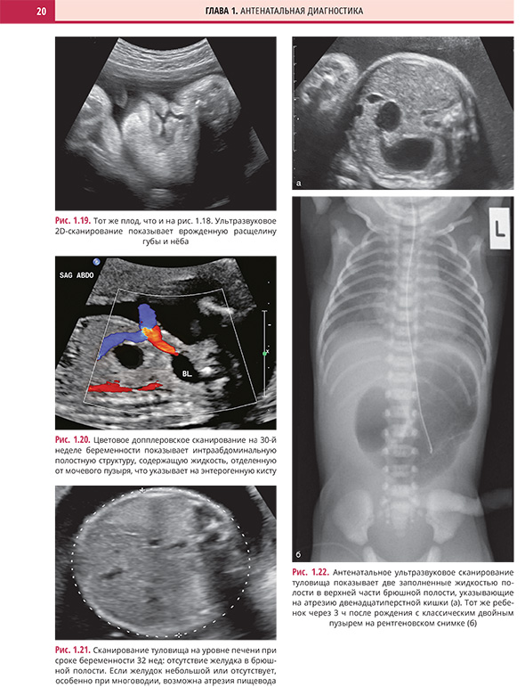 Цветовое допплеровское сканирование