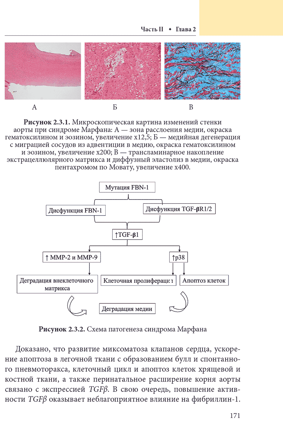 Рисунок 2.3.2. Схема патогенеза синдрома Марфана