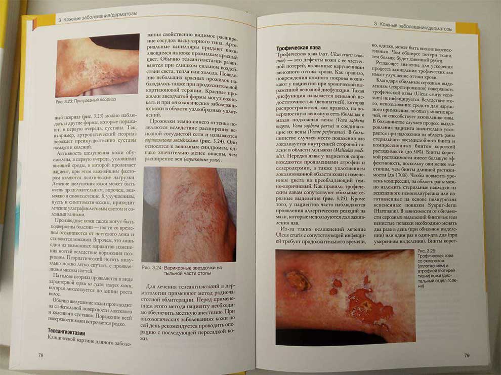 Пример страницы из книги "Теория медицинского педикюра" - Клаус Грюневальд