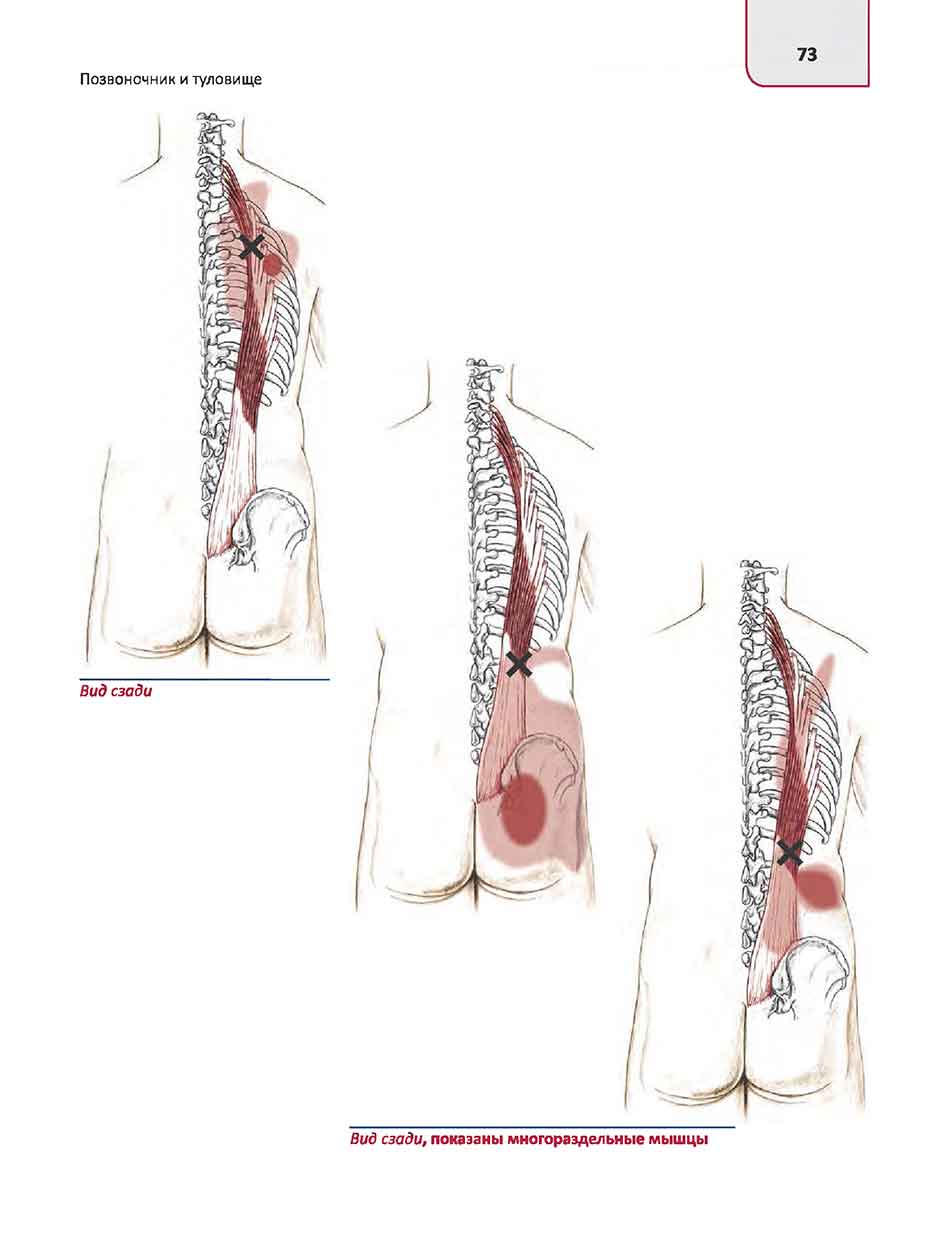 Вид сзади, показаны многораздельные мышцы