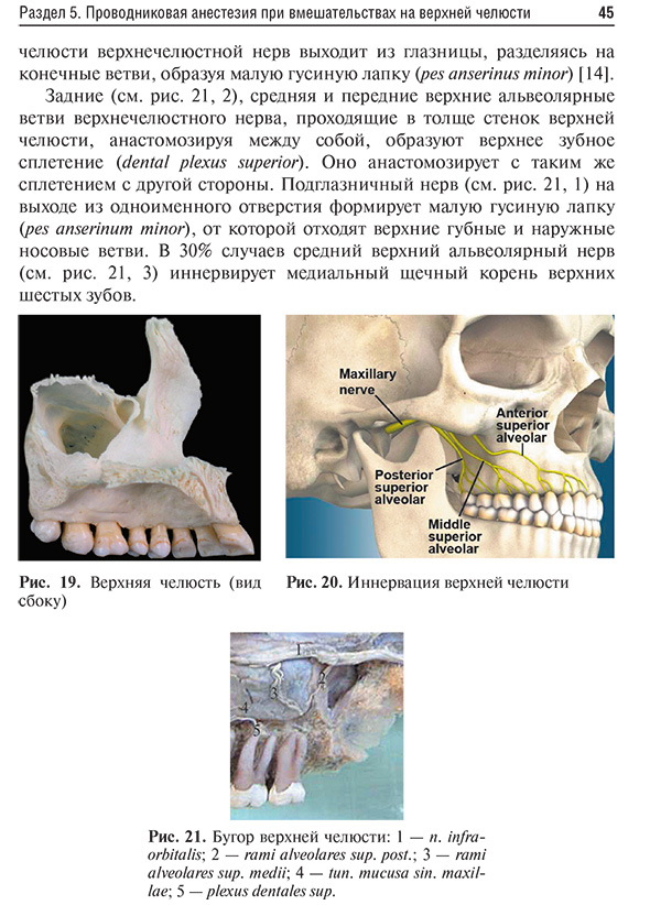 Бугор верхней челюсти