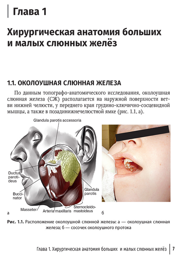 Расположение околоушной слюнной железы