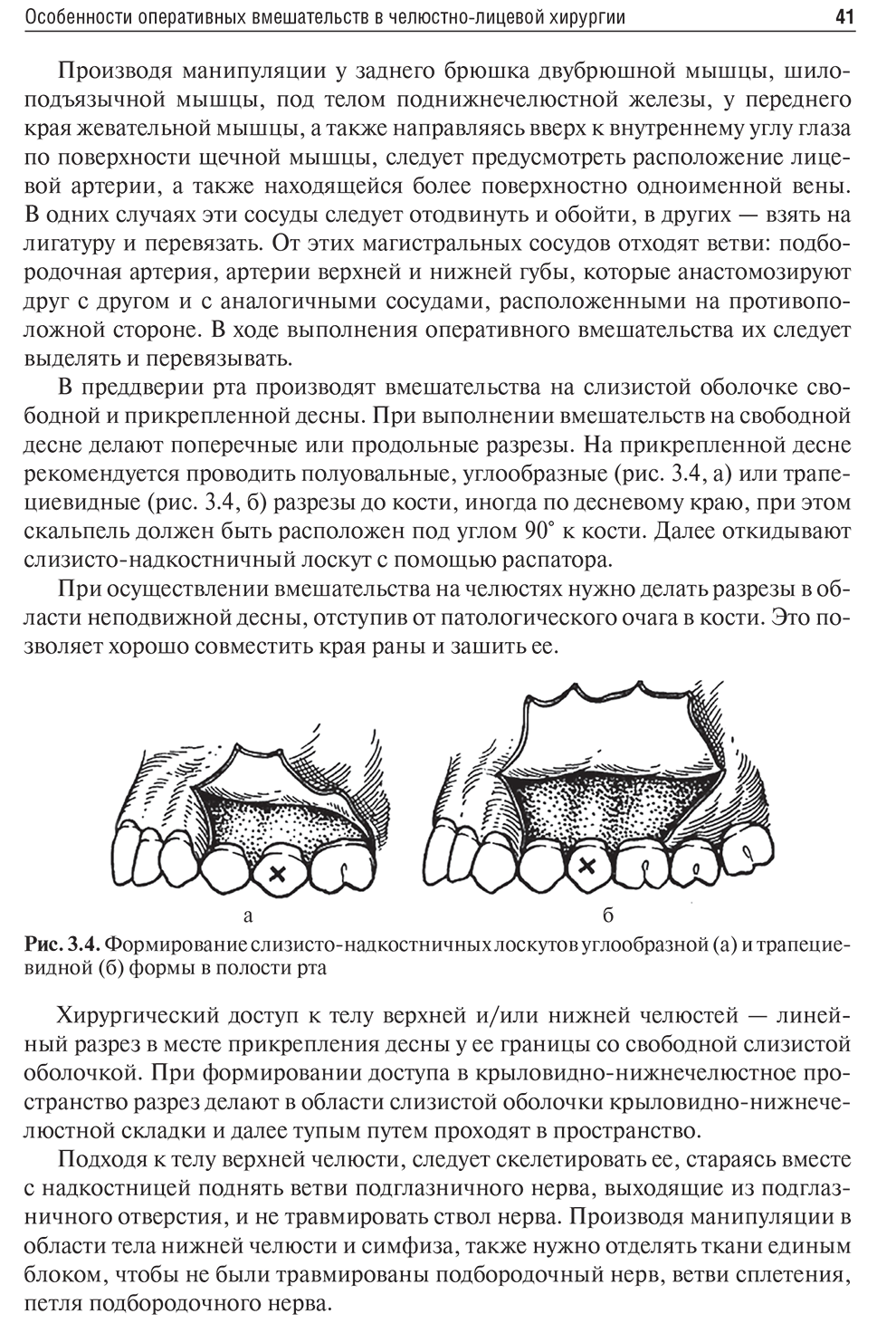 Формирование слизисто-надкостничных лоскутов углообразной