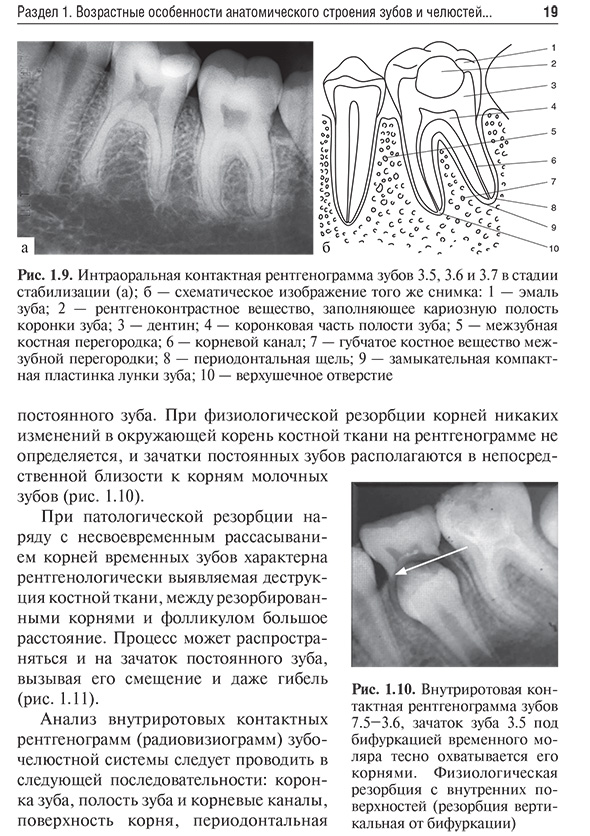 Интраоральная контактная рентгенограмма зубов Интраоральная контактная рентгенограмма зубов