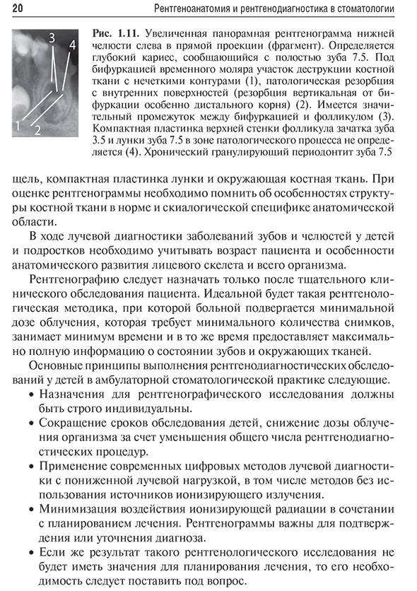 Увеличенная панорамная рентгенограмма Увеличенная панорамная рентгенограмма