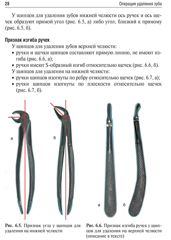 Рис. 6.5. Признак угла у щипцов для удаления на нижней челюсти