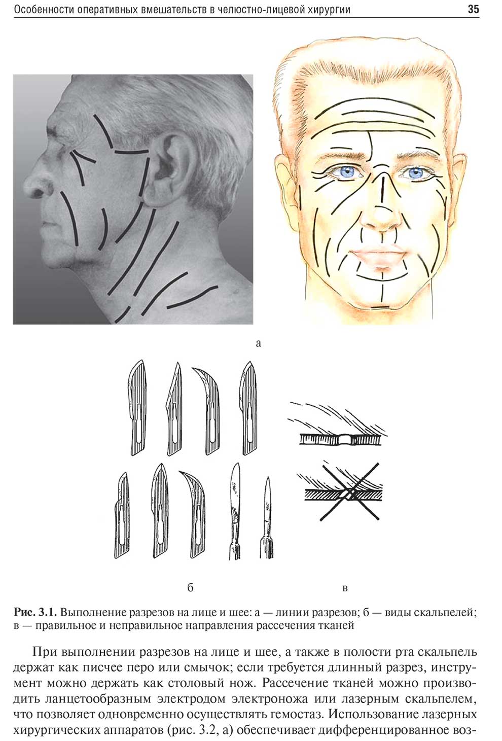 Выполнение разрезов на лице и шее